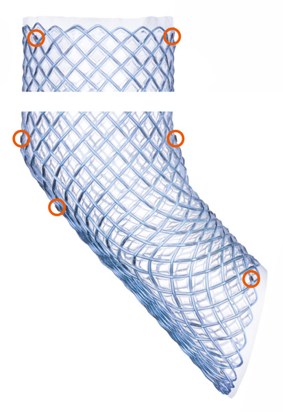 Tantalum X-ray markers Tantalum X-ray markers